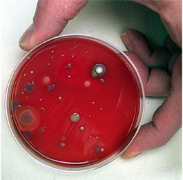 Bacteria Growth in Culture Plate